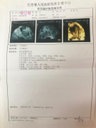 懷孕難，難于上青天?“世紀(jì)”巧施妙手助好孕